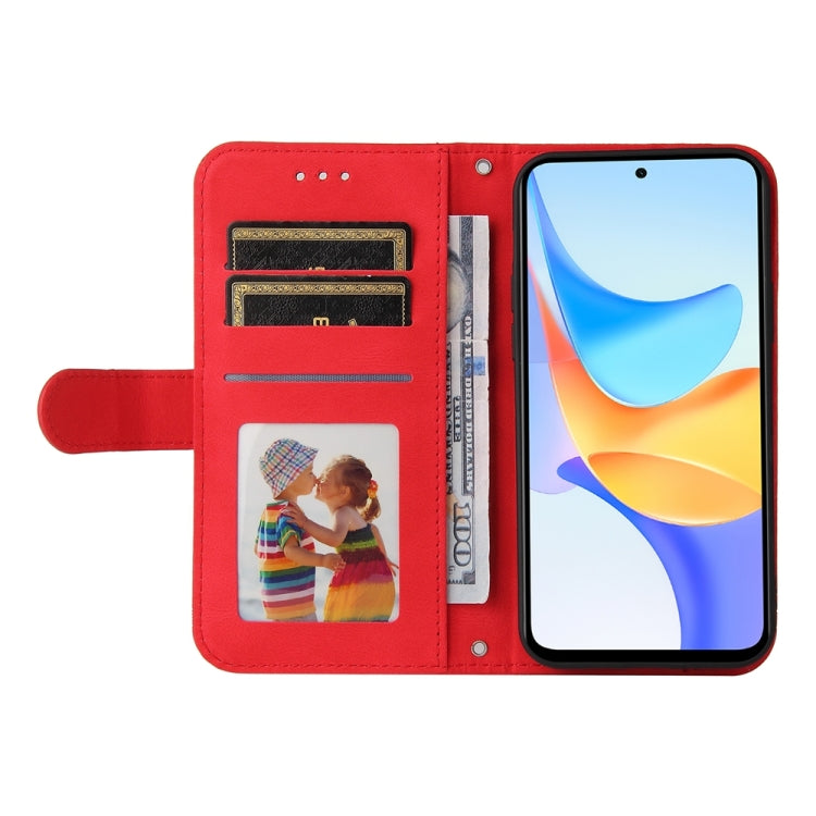 Skin Feel Life Tree Metal Button Leather Phone Case, For Honor Play 50 Plus, For Honor X6a, For Honor X50i 5G