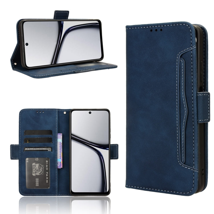 Skin Feel Calf Texture Card Slots Leather Phone Case, For Realme 11 Pro / 11 Pro+, For Realme C65 4G, For Realme GT Neo5 SE