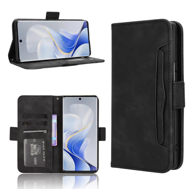 Skin Feel Calf Texture Card Slots Leather Phone Case, For vivo X200 5G, For vivo X200 Pro mini 5G, For vivo X200 Pro 5G, For vivo V40 Lite 4G / 5G IDN, For vivo V40e 5G / iQOO Z9S 5G, For vivo T3 Pro 5G / iQOO Z9S Pro 5G, For vivo V30e 5G / V40 Lite 5G...