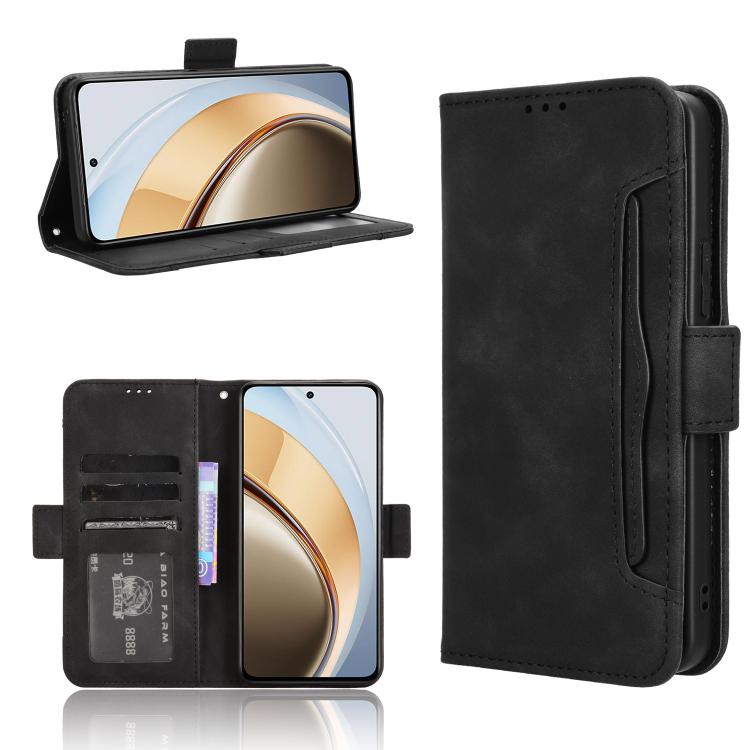 Skin Feel Calf Texture Card Slots Leather Phone Case, For vivo X200 5G, For vivo X200 Pro mini 5G, For vivo X200 Pro 5G, For vivo V40 Lite 4G / 5G IDN, For vivo V40e 5G / iQOO Z9S 5G, For vivo T3 Pro 5G / iQOO Z9S Pro 5G, For vivo V30e 5G / V40 Lite 5G...