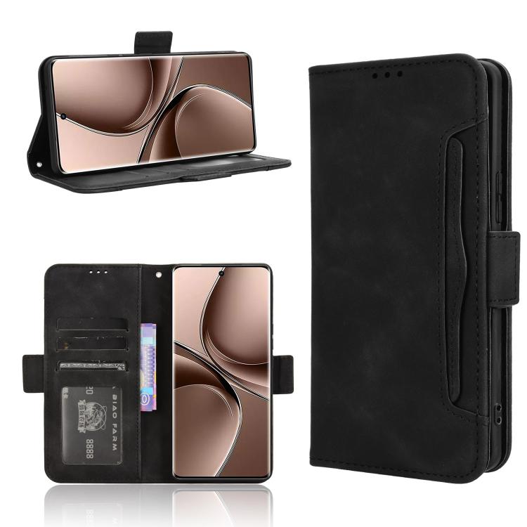 Skin Feel Calf Texture Card Slots Leather Phone Case, For vivo X200 5G, For vivo X200 Pro mini 5G, For vivo X200 Pro 5G, For vivo V40 Lite 4G / 5G IDN, For vivo V40e 5G / iQOO Z9S 5G, For vivo T3 Pro 5G / iQOO Z9S Pro 5G, For vivo V30e 5G / V40 Lite 5G...