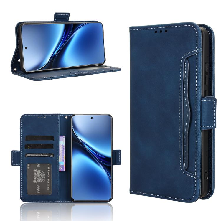 Skin Feel Calf Texture Card Slots Leather Phone Case, For vivo X200 5G, For vivo X200 Pro mini 5G, For vivo X200 Pro 5G, For vivo V40 Lite 4G / 5G IDN, For vivo V40e 5G / iQOO Z9S 5G, For vivo T3 Pro 5G / iQOO Z9S Pro 5G, For vivo V30e 5G / V40 Lite 5G...