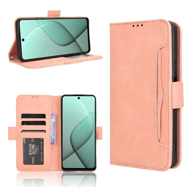 Skin Feel Calf Texture Card Slots Leather Phone Case, For Tecno Spark Go 1 / Pop 9 / Spark Go 2025, For Tecno Spark 30C 4G, For Tecno Spark 20 Pro 5G, For Tecno Camon 30 Premier 5G, For Tecno Pova 6 Neo 4G, For Tecno Pova 6 4G, For Tecno Camon 30 Pro 5...