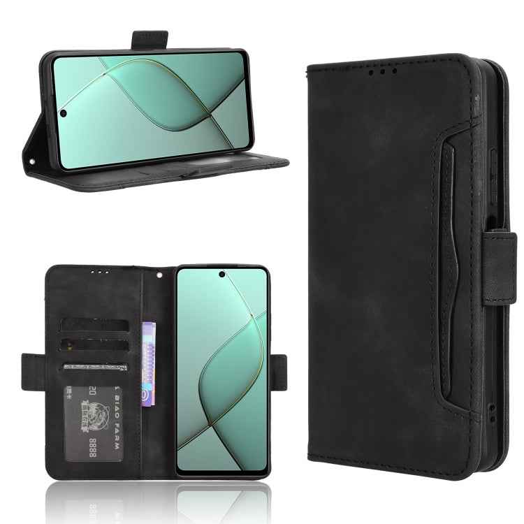 Skin Feel Calf Texture Card Slots Leather Phone Case, For Tecno Spark Go 1 / Pop 9 / Spark Go 2025, For Tecno Spark 30C 4G, For Tecno Spark 20 Pro 5G, For Tecno Camon 30 Premier 5G, For Tecno Pova 6 Neo 4G, For Tecno Pova 6 4G, For Tecno Camon 30 Pro 5...