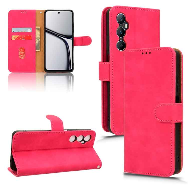 Skin Feel Magnetic Flip Leather Phone Case, For Realme 11 Pro / 11 Pro+, For Realme C65 4G