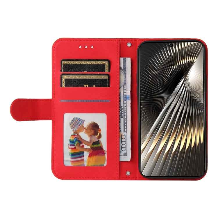 Skin Feel Life Tree Metal Button Leather Phone Case, For Xiaomi Poco F6, For Xiaomi Redmi A3, For Xiaomi Redmi Note13 Pro 4G Global/Poco M6 Pro 4G, For Xiaomi Redmi Note13 4G, For Xiaomi Redmi K70E, For Xiaomi 14 Ultra, For Xiaomi 14 Pro, For Xiaomi 14...