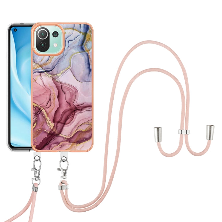 Electroplating Marble Dual-side IMD Phone Case with Lanyard