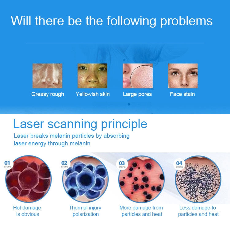 Handheld Picosecond Portable (Removing Tattoo Freckle Mole Dot) Machine Laser Plasma Beauty Care Pen, USB / Red Light, USB / Blue Light