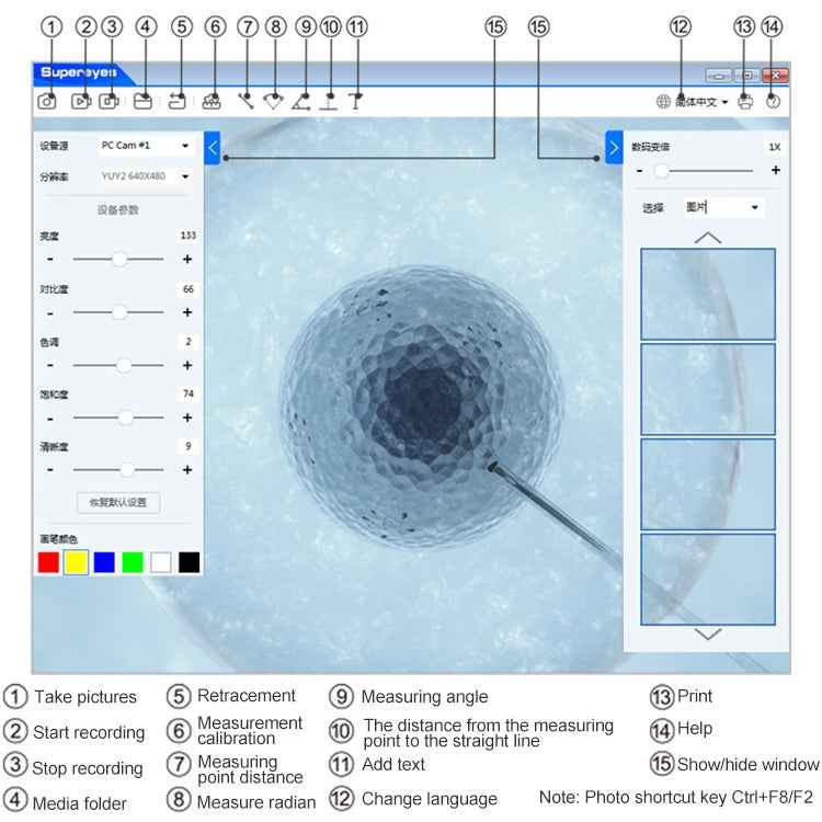 Supereyes Y001 Ear Mite Mouth Electronic Digital Fixed Focus Endoscope