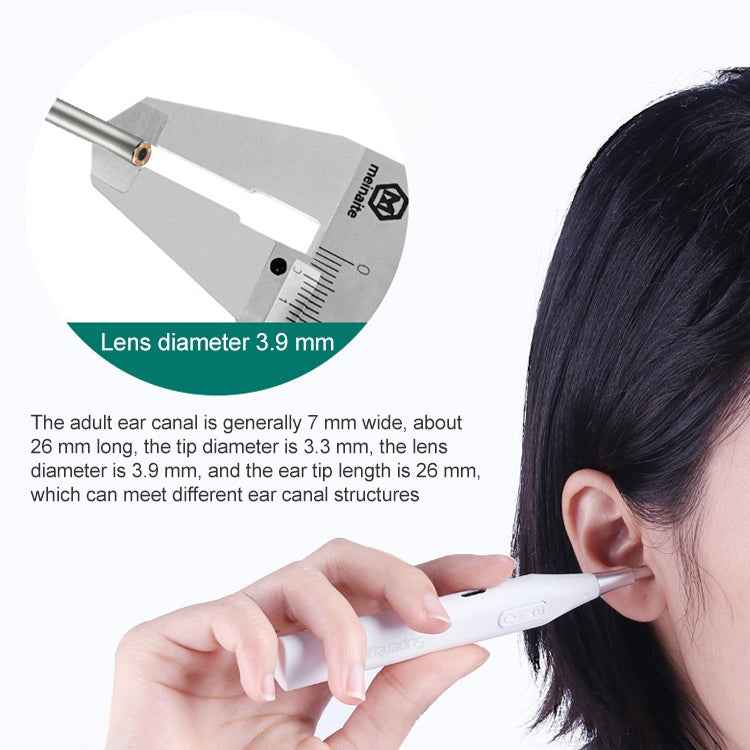 Supereyes Y009 Visual Ear Pick Acne Cleaning Microscopic Magnifying Mirror Endoscope