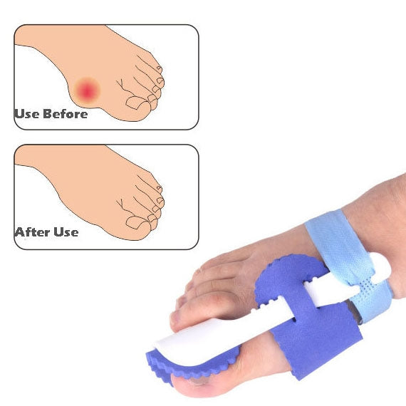 1 Pair ZRWC14 Bunio Night Splint Straightener, ZRWC14