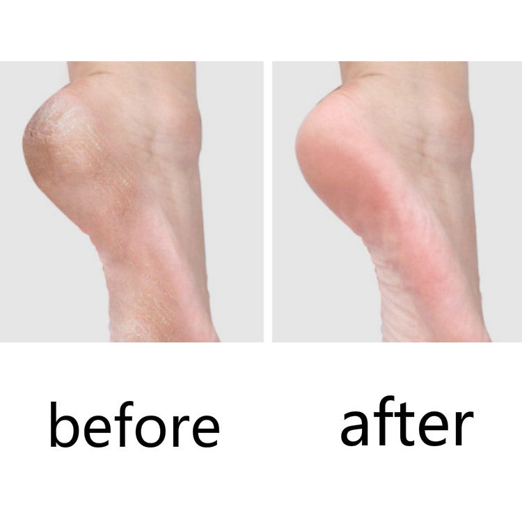 10 PCS Pedicure Knife For Dead Skin Calluses