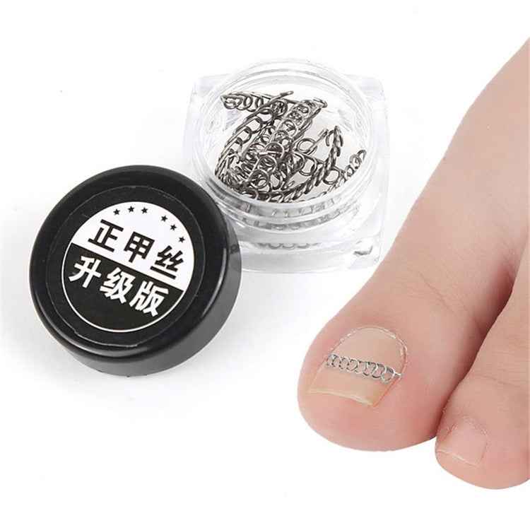 12 in 1 Toenail Orthosis With Ingrown Toenails