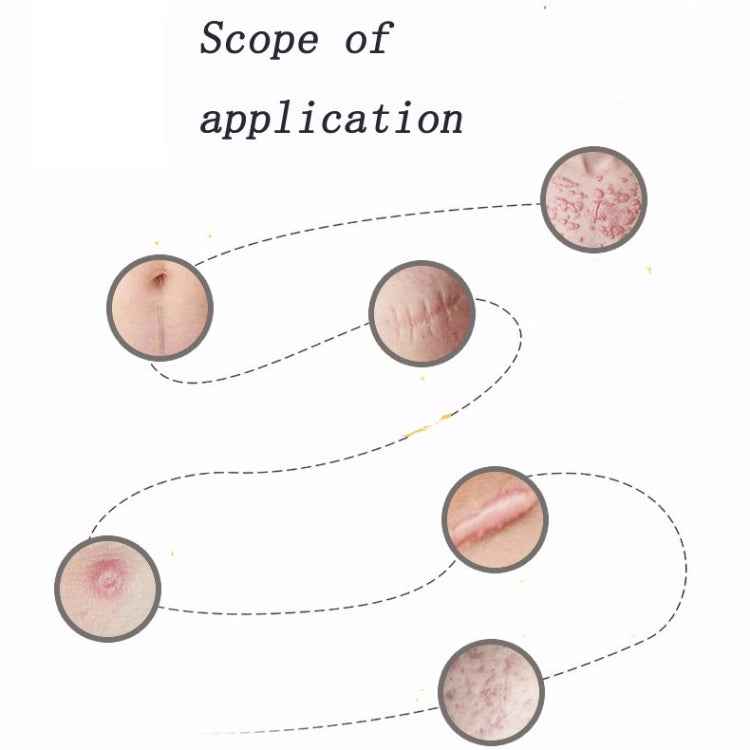 Organic silicone Gel Scar Therapy Patch be Washed and Reused