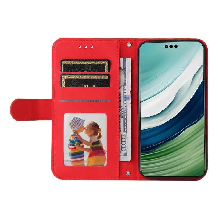 Skin Feel Life Tree Metal Button Leather Phone Case, For Huawei Mate 60 Pro, For Huawei Enjoy 60X, For Huawei nova 11 Pro, For Huawei nova 11