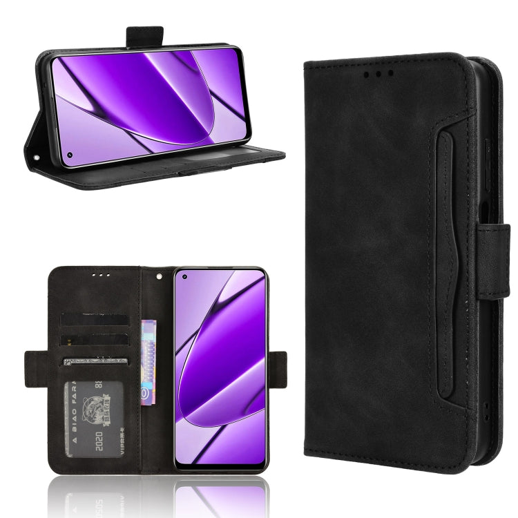 Skin Feel Calf Texture Card Slots Leather Phone Case, For Realme 12 / 12x 5G, For Realme Narzo 70 Pro 5G, For Realme 12+ 5G, For Realme Note 50 4G, For Realme 12 Pro / 12 Pro+ 5G, For Realme C67 4G, For Realme 11 4G Foreign, For Realme GT5 5G          ...