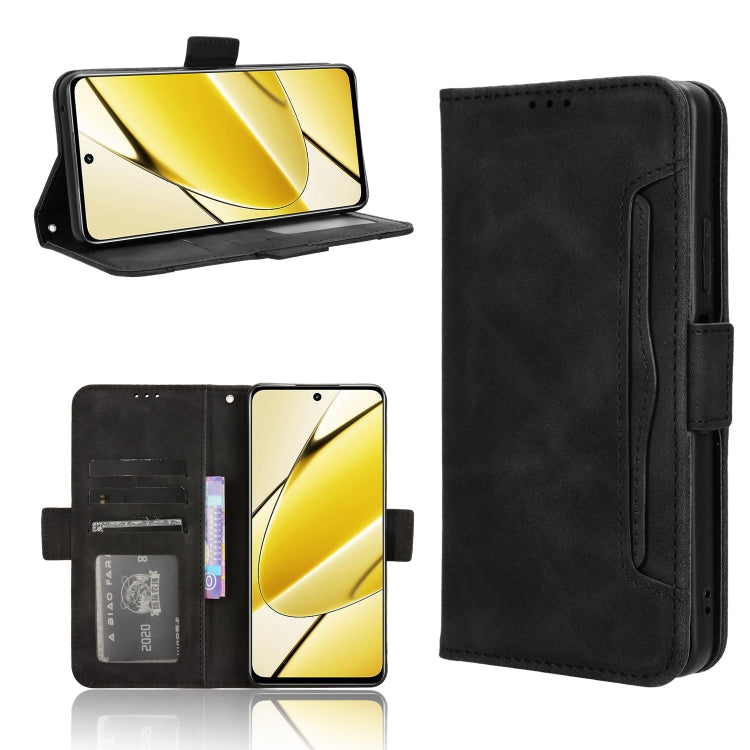 Skin Feel Calf Texture Card Slots Leather Phone Case, For Realme 12 / 12x 5G, For Realme Narzo 70 Pro 5G, For Realme 12+ 5G, For Realme Note 50 4G, For Realme 12 Pro / 12 Pro+ 5G, For Realme C67 4G, For Realme 11 4G Foreign, For Realme GT5 5G          ...