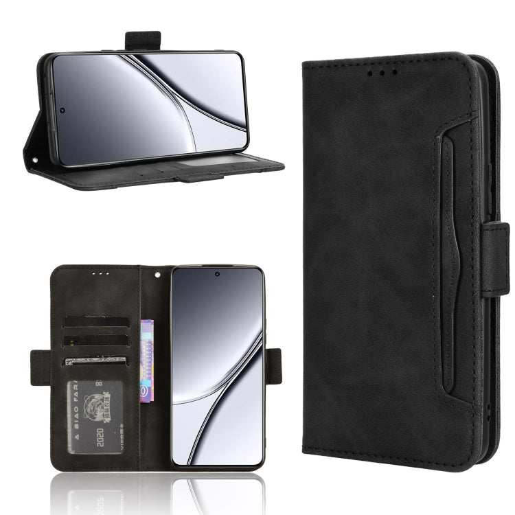 Skin Feel Calf Texture Card Slots Leather Phone Case, For Realme 12 / 12x 5G, For Realme Narzo 70 Pro 5G, For Realme 12+ 5G, For Realme Note 50 4G, For Realme 12 Pro / 12 Pro+ 5G, For Realme C67 4G, For Realme 11 4G Foreign, For Realme GT5 5G          ...