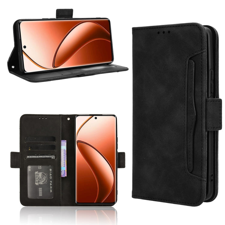 Skin Feel Calf Texture Card Slots Leather Phone Case, For Realme 12 / 12x 5G, For Realme Narzo 70 Pro 5G, For Realme 12+ 5G, For Realme Note 50 4G, For Realme 12 Pro / 12 Pro+ 5G, For Realme C67 4G, For Realme 11 4G Foreign, For Realme GT5 5G          ...