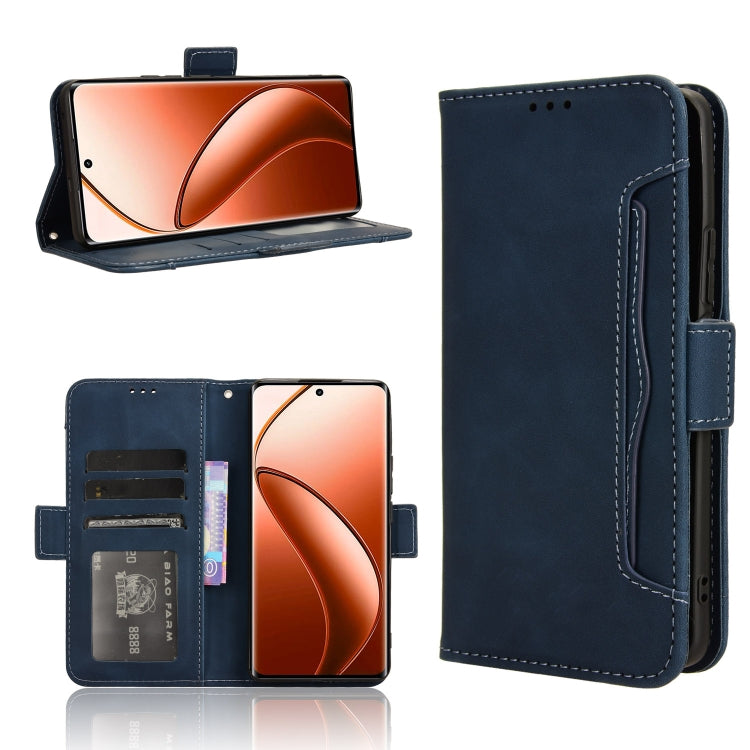 Skin Feel Calf Texture Card Slots Leather Phone Case, For Realme 12 / 12x 5G, For Realme Narzo 70 Pro 5G, For Realme 12+ 5G, For Realme Note 50 4G, For Realme 12 Pro / 12 Pro+ 5G, For Realme C67 4G, For Realme 11 4G Foreign, For Realme GT5 5G          ...