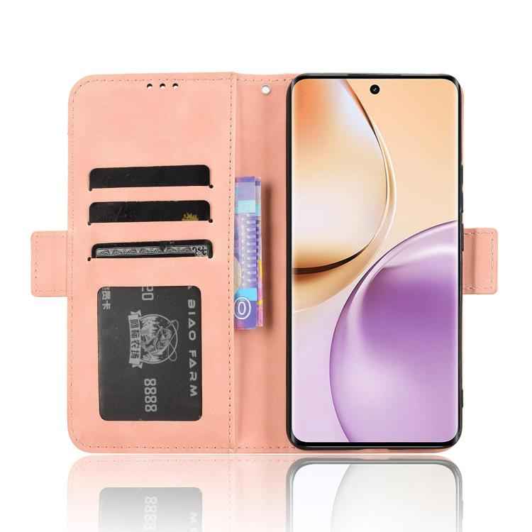 Skin Feel Calf Texture Card Slots Leather Phone Case, For Realme 14 Pro 5G, For Realme C75 4G, For Realme GT 7 Pro 5G, For Realme 13+ 5G Global, For Realme 13 Pro 5G / 13 Pro+ 5G, For Realme GT 6 / GT 6T / GT Neo6                                       ...