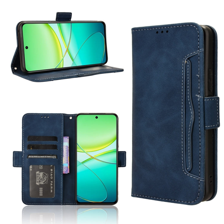 Skin Feel Calf Texture Card Slots Leather Phone Case, For vivo S19 5G, For vivo Y28 4G, For vivo X100 Ultra 5G, For vivo Y38 5G / Y200i 5G, For vivo Y03 4G, For vivo Y200e 5G / Y100 5G IND, For vivo S18 5G / S18 Pro 5G, For vivo V30 5G / V30 Pro 5G    ...