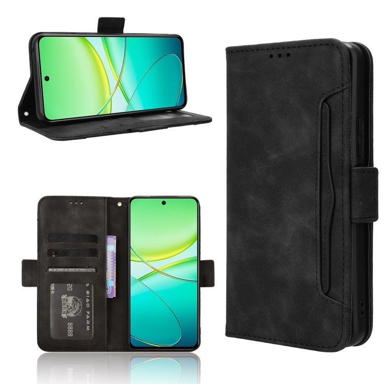Skin Feel Calf Texture Card Slots Leather Phone Case, For vivo X200 5G, For vivo X200 Pro mini 5G, For vivo X200 Pro 5G, For vivo V40 Lite 4G / 5G IDN, For vivo V40e 5G / iQOO Z9S 5G, For vivo T3 Pro 5G / iQOO Z9S Pro 5G, For vivo V30e 5G / V40 Lite 5G...
