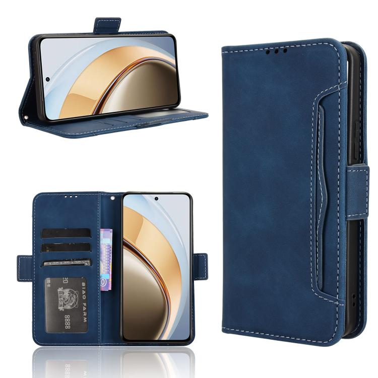 Skin Feel Calf Texture Card Slots Leather Phone Case, For vivo X200 5G, For vivo X200 Pro mini 5G, For vivo X200 Pro 5G, For vivo V40 Lite 4G / 5G IDN, For vivo V40e 5G / iQOO Z9S 5G, For vivo T3 Pro 5G / iQOO Z9S Pro 5G, For vivo V30e 5G / V40 Lite 5G...