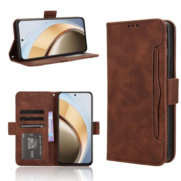 Skin Feel Calf Texture Card Slots Leather Phone Case, For vivo X200 5G, For vivo X200 Pro mini 5G, For vivo X200 Pro 5G, For vivo V40 Lite 4G / 5G IDN, For vivo V40e 5G / iQOO Z9S 5G, For vivo T3 Pro 5G / iQOO Z9S Pro 5G, For vivo V30e 5G / V40 Lite 5G...