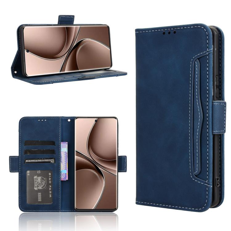 Skin Feel Calf Texture Card Slots Leather Phone Case, For vivo X200 5G, For vivo X200 Pro mini 5G, For vivo X200 Pro 5G, For vivo V40 Lite 4G / 5G IDN, For vivo V40e 5G / iQOO Z9S 5G, For vivo T3 Pro 5G / iQOO Z9S Pro 5G, For vivo V30e 5G / V40 Lite 5G...