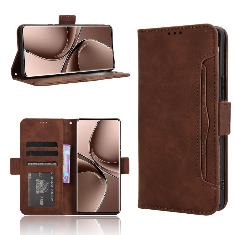 Skin Feel Calf Texture Card Slots Leather Phone Case, For vivo X200 5G, For vivo X200 Pro mini 5G, For vivo X200 Pro 5G, For vivo V40 Lite 4G / 5G IDN, For vivo V40e 5G / iQOO Z9S 5G, For vivo T3 Pro 5G / iQOO Z9S Pro 5G, For vivo V30e 5G / V40 Lite 5G...