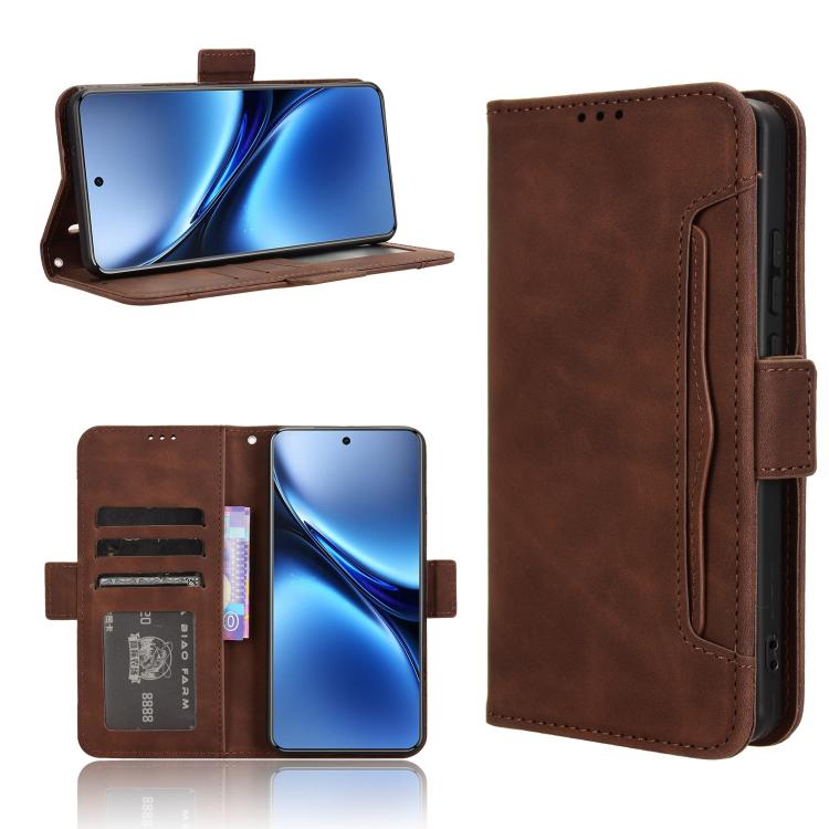 Skin Feel Calf Texture Card Slots Leather Phone Case, For vivo X200 5G, For vivo X200 Pro mini 5G, For vivo X200 Pro 5G, For vivo V40 Lite 4G / 5G IDN, For vivo V40e 5G / iQOO Z9S 5G, For vivo T3 Pro 5G / iQOO Z9S Pro 5G, For vivo V30e 5G / V40 Lite 5G...