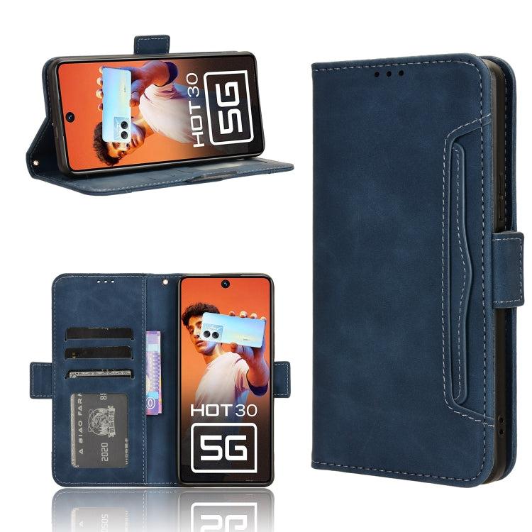 Skin Feel Calf Texture Card Slots Leather Phone Case, For Infinix Hot 30 5G X6832, For Infinix Smart 7 Plus, For Infinix Note 30 5G, For Infinix Smart 7 HD X6516, For Infinix Note 30i, For Infinix Note 30 Pro, For Infinix Note 30 4G                    ...
