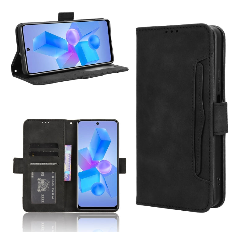 Skin Feel Calf Texture Card Slots Leather Phone Case, For Infinix Note 40 Pro 4G, For Infinix Note 40 Pro 5G, For Infinix Note 40 4G, For Infinix Hot 40 4G, For Infinix Hot 40i 4G, For Infinix Smart 8, For Infinix Zero 30 4G, For Infinix Zero 30 5G    ...