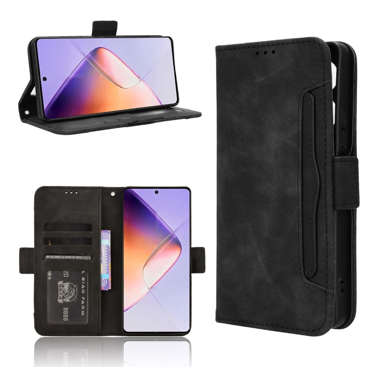 Skin Feel Calf Texture Card Slots Leather Phone Case, For Infinix Note 40 Pro 4G, For Infinix Note 40 Pro 5G, For Infinix Note 40 4G, For Infinix Hot 40 4G, For Infinix Hot 40i 4G, For Infinix Smart 8, For Infinix Zero 30 4G, For Infinix Zero 30 5G    ...