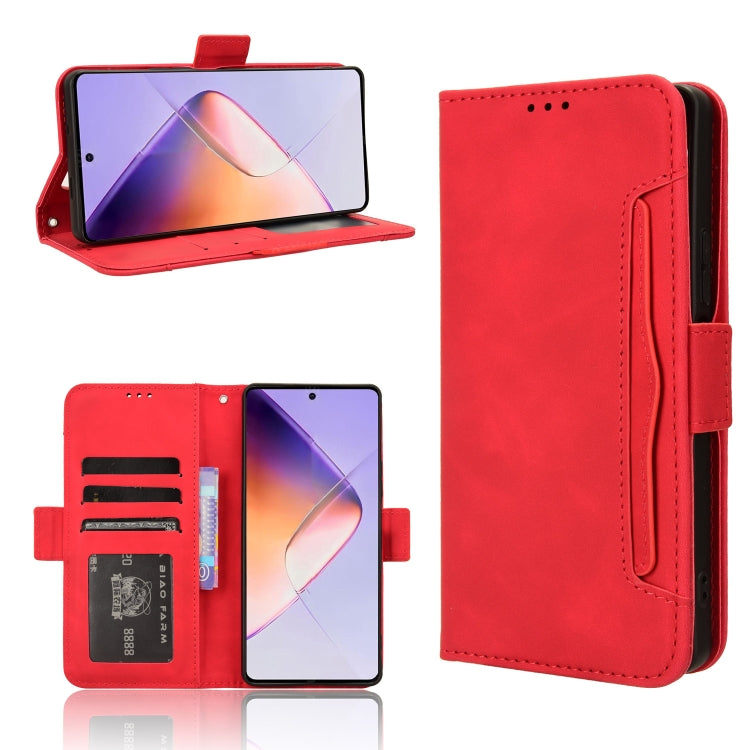 Skin Feel Calf Texture Card Slots Leather Phone Case, For Infinix Note 40 Pro 4G, For Infinix Note 40 Pro 5G, For Infinix Note 40 4G, For Infinix Hot 40 4G, For Infinix Hot 40i 4G, For Infinix Smart 8, For Infinix Zero 30 4G, For Infinix Zero 30 5G    ...