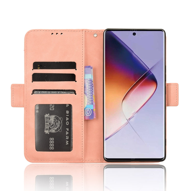 Skin Feel Calf Texture Card Slots Leather Phone Case, For Infinix Note 40 Pro 4G, For Infinix Note 40 Pro 5G, For Infinix Note 40 4G, For Infinix Hot 40 4G, For Infinix Hot 40i 4G, For Infinix Smart 8, For Infinix Zero 30 4G, For Infinix Zero 30 5G    ...