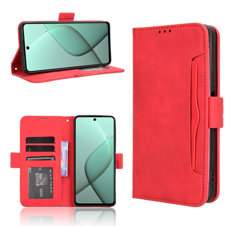 Skin Feel Calf Texture Card Slots Leather Phone Case, For Tecno Spark 30 4G, For Tecno Spark Go 1 / Pop 9 / Spark Go 2025, For Tecno Spark 30C 4G, For Tecno Spark 20 Pro 5G, For Tecno Camon 30 Premier 5G, For Tecno Pova 6 Neo 4G, For Tecno Pova 6 4G   ...
