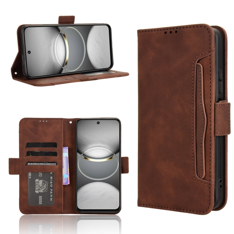 Skin Feel Calf Texture Card Slots Leather Phone Case, For Tecno Spark 30 4G, For Tecno Spark Go 1 / Pop 9 / Spark Go 2025, For Tecno Spark 30C 4G, For Tecno Spark 20 Pro 5G, For Tecno Camon 30 Premier 5G, For Tecno Pova 6 Neo 4G, For Tecno Pova 6 4G   ...