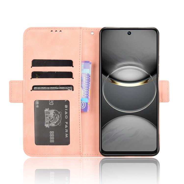 Skin Feel Calf Texture Card Slots Leather Phone Case, For Tecno Spark 30 4G, For Tecno Spark Go 1 / Pop 9 / Spark Go 2025, For Tecno Spark 30C 4G, For Tecno Spark 20 Pro 5G, For Tecno Camon 30 Premier 5G, For Tecno Pova 6 Neo 4G, For Tecno Pova 6 4G   ...