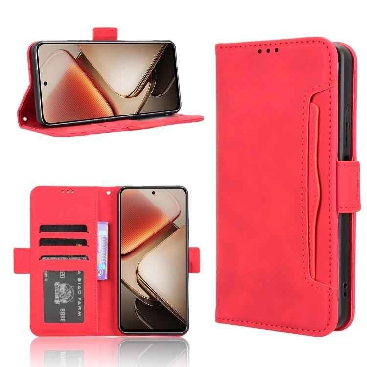 Skin Feel Calf Texture Card Slots Leather Phone Case, For Oukitel C68, For Oukitel C62 / C62 Pro, For Oukitel C69, For Oukitel C59 / C59 Pro, For Oukitel C1 / C1 Pro, For Oukitel C60 / C60 Pro, For Oukitel C65 / C65 Pro, For Oukitel C61 / C61 Pro������...