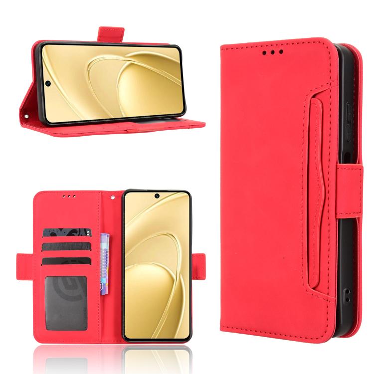 Skin Feel Calf Texture Card Slots Leather Phone Case, For Oukitel C17 4G 2026, For Oukitel C26, For Oukitel C68, For Oukitel C62 / C62 Pro, For Oukitel C69, For Oukitel C59 / C59 Pro, For Oukitel C1 / C1 Pro, For Oukitel C60 / C60 Pro                  ...
