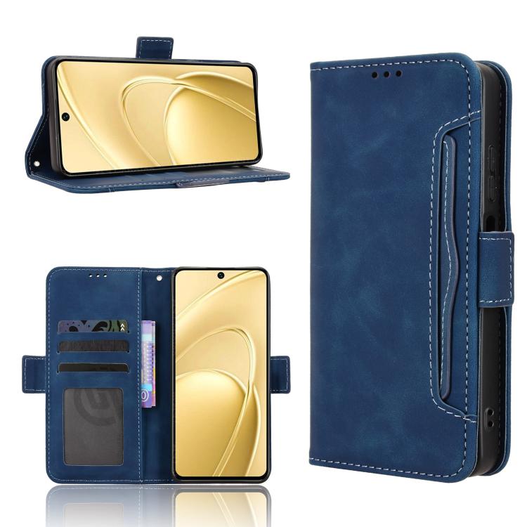 Skin Feel Calf Texture Card Slots Leather Phone Case, For Oukitel C17 4G 2026, For Oukitel C26, For Oukitel C68, For Oukitel C62 / C62 Pro, For Oukitel C69, For Oukitel C59 / C59 Pro, For Oukitel C1 / C1 Pro, For Oukitel C60 / C60 Pro                  ...