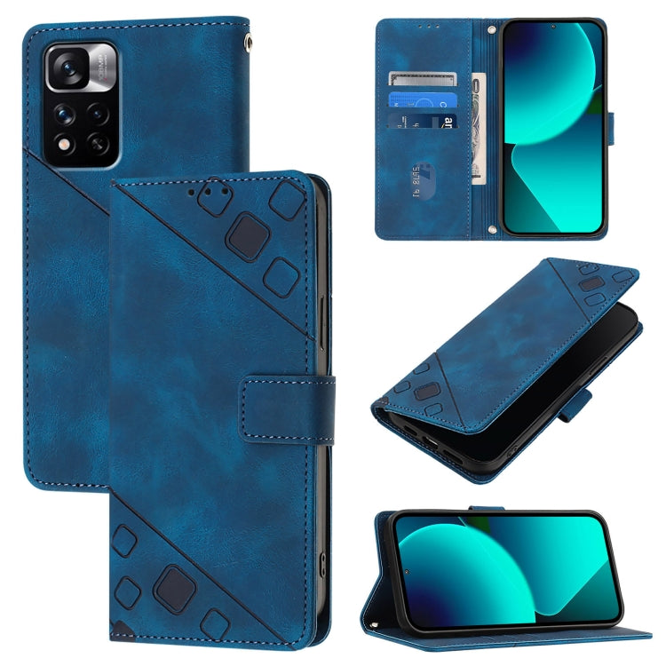 Skin Feel Embossed Leather Phone Case, For Xiaomi Civi 3, For Xiaomi Poco M5s / Redmi Note 11 SE India, For Xiaomi Poco X4 NFC 5G, For Xiaomi Redmi Note 11 Pro+ 5G EU, For Xiaomi Civi 1S, For Xiaomi Poco M4 Pro 5G / Redmi Note 11S 5G                   ...