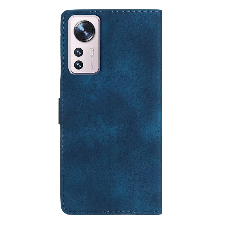 Flower Butterfly Embossing Pattern Leather Phone Case, For Xiaomi 12 Pro, For Xiaomi Redmi A1, For Xiaomi Redmi Note 11 Pro 5G Global, For Xiaomi 12 Lite, For Xiaomi Redmi 10C, For Xiaomi Redmi Note 11 4G Global / Note 11S, For Xiaomi Redmi 10 2022    ...