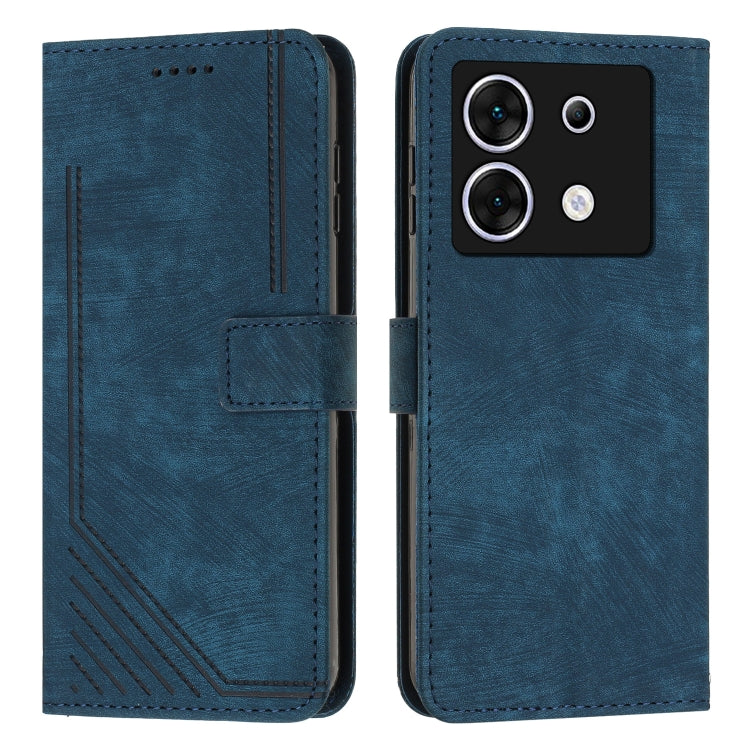 Skin Feel Stripe Pattern Leather Phone Case with Lanyard, For Infinix Note 40 4G, For Infinix Hot 40 / 40 Pro, For Infinix Hot 40i, For Infinix Smart 8, For Infinix Zero 30 4G, For Infinix Zero 30 5G, For Infinix Hot 30 Play NFC                        ...