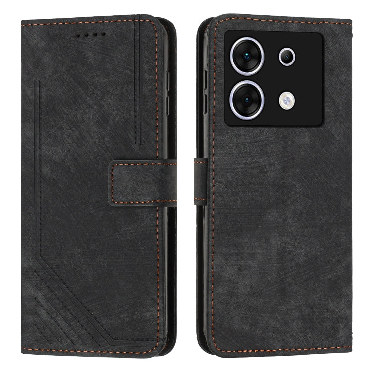 Skin Feel Stripe Pattern Leather Phone Case with Lanyard, For Infinix Zero 30 4G, For Infinix Zero 30 5G, For Infinix Hot 30 Play NFC, For Infinix Note 30/Note 30 5G, For Infinix Note 30i, For Infinix Note 30 Pro, For Infinix Note 30 VIP               ...