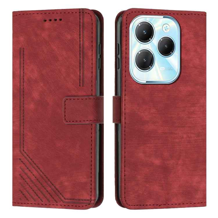 Skin Feel Stripe Pattern Leather Phone Case with Lanyard, For Infinix Note 40 4G, For Infinix Hot 40 / 40 Pro, For Infinix Hot 40i, For Infinix Smart 8, For Infinix Zero 30 4G, For Infinix Zero 30 5G, For Infinix Hot 30 Play NFC                        ...