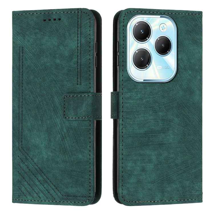 Skin Feel Stripe Pattern Leather Phone Case with Lanyard, For Infinix Note 40 4G, For Infinix Hot 40 / 40 Pro, For Infinix Hot 40i, For Infinix Smart 8, For Infinix Zero 30 4G, For Infinix Zero 30 5G, For Infinix Hot 30 Play NFC                        ...