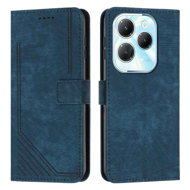 Skin Feel Stripe Pattern Leather Phone Case with Lanyard, For Infinix Note 40 4G, For Infinix Hot 40 / 40 Pro, For Infinix Hot 40i, For Infinix Smart 8, For Infinix Zero 30 4G, For Infinix Zero 30 5G, For Infinix Hot 30 Play NFC                        ...